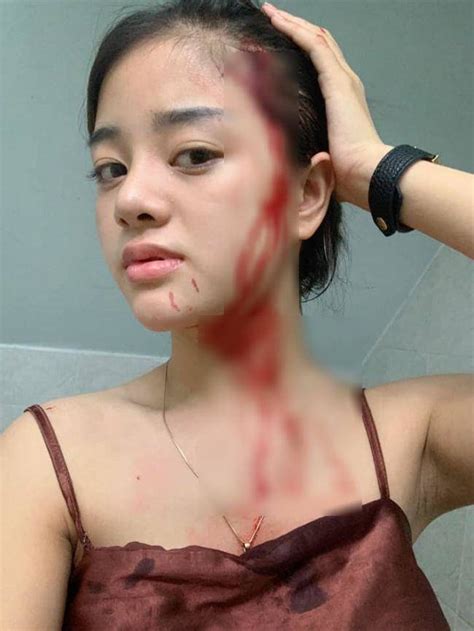 hot girl không ai ngờ lại lận đận tình duyên bị bạn trai hoặc chồng cũ đánh đập