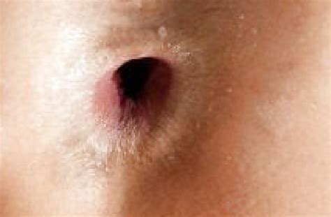 Anus Porn Pictures XXX Photos Sex Images PICTOA
