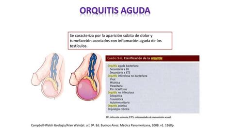 Epididimitis Y Orquitis Aguda Y Cronica 1