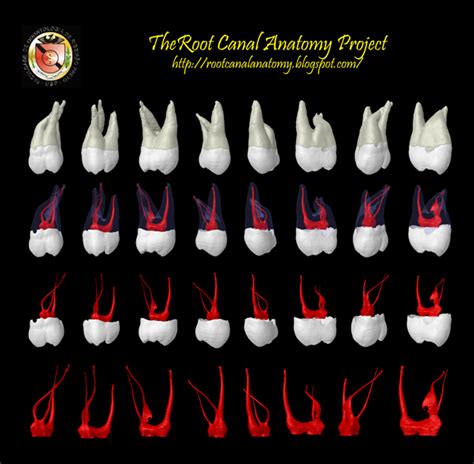 The Root Canal Anatomy Project Maxillary Second Molar