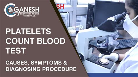 Platelets Count Blood Test Causes Symptoms And Diagnosing Procedure