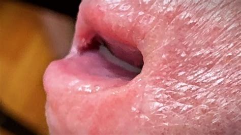 Look Inside Cock Endoscope With Tube Introducing Cam Deep French Gay Man Porn XHamster