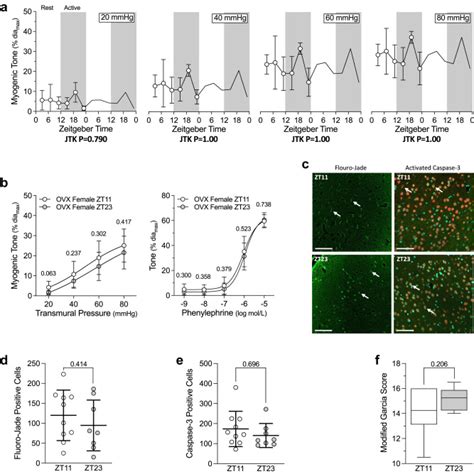 Female Mice Display Sex Specific Differences In Cerebrovascular Function And Subarachnoid