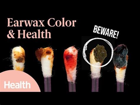Why Is Impacted Ear Wax Black