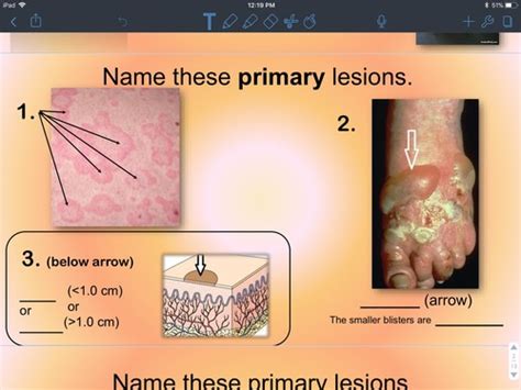 Dermatology Exam 1 Flashcards Quizlet