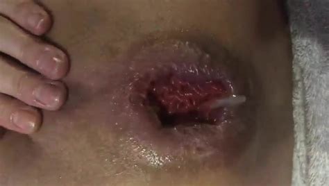 Moscow Anal And Vaginal Fisting Free Porn D XHamster XHamster