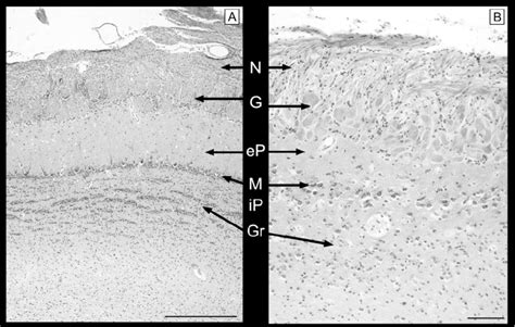 Nissl Stained Sagittal Sections Of The Main A And Accessory B