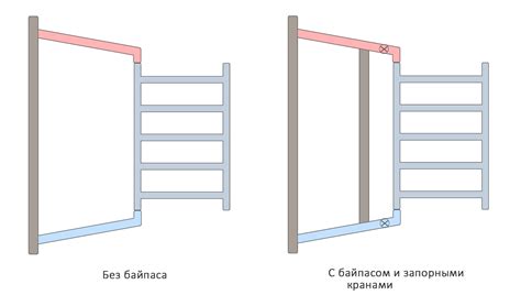 Байпас – зачем он нужен?