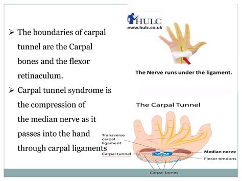 Projections of carpal tunnel and wrist | PPT