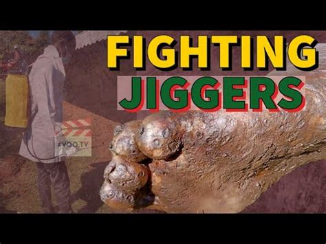 #VOO TV Fighting JIGGERS In KISII CAMPAIGN - YouTube