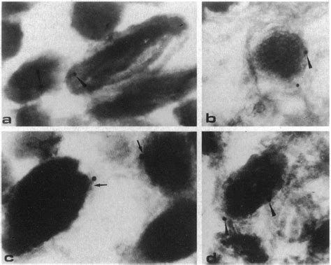 Electron Micrograph Of Melanosomes In Cultured Human Melanocytes A