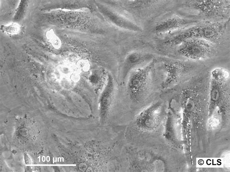 Rcc Gh Cells