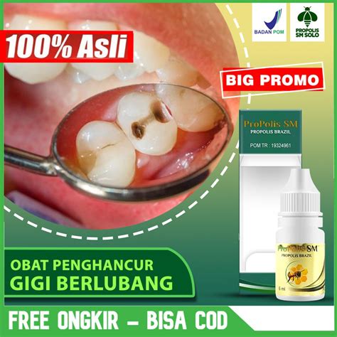 Jual Obat Penghancur Gigi Berlubang Perontok Karang Gigi Obat Sakit