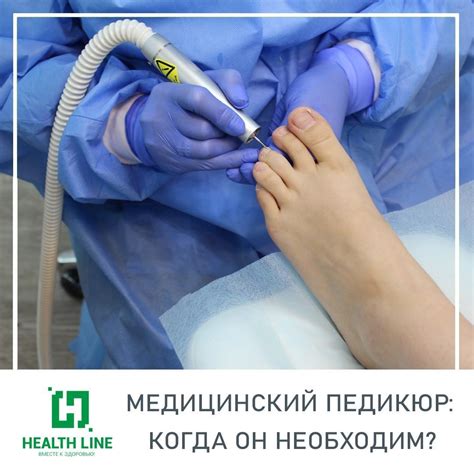 Медицинский педикюр
