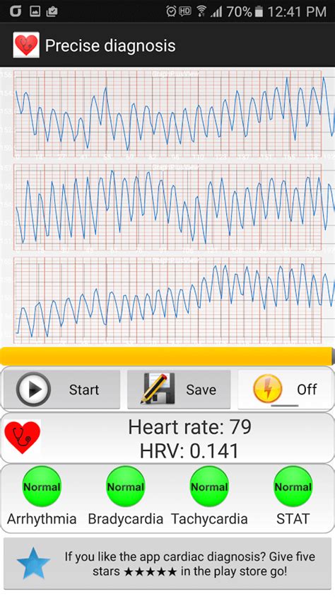 Best Heart Rate Monitor Apps For Android Iphone Techwarior