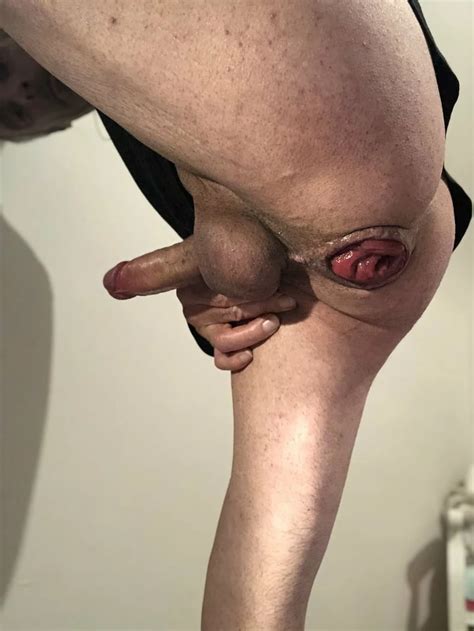 Wow Magic This Anal Prolapse Pics Xhamster