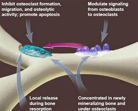 Bifosfonati In Odontoiatria Ed Osteonecrosi Dei Mascellari Zerodonto