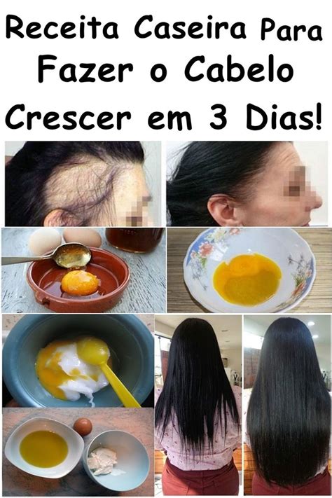 Receita Caseira Para Fazer O Cabelo Crescer Em Dias Hair Beauty Body