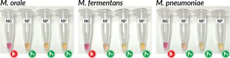 마이코플라즈마 오염여부 장비 필요없이 눈으로 색깔변화 확인 Mycoplasma Detection Kit Bric