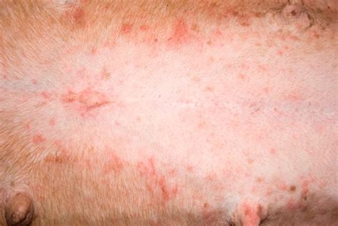 What do Flea Bites Look Like - Flea Bite Pictures - FLEABITES