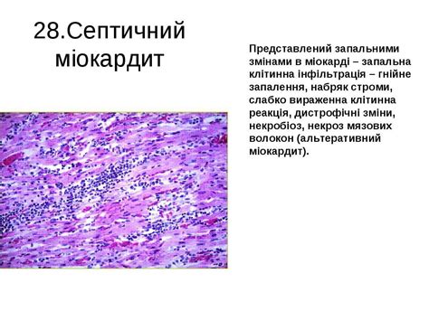Мікропрепарати - презентація з медицини