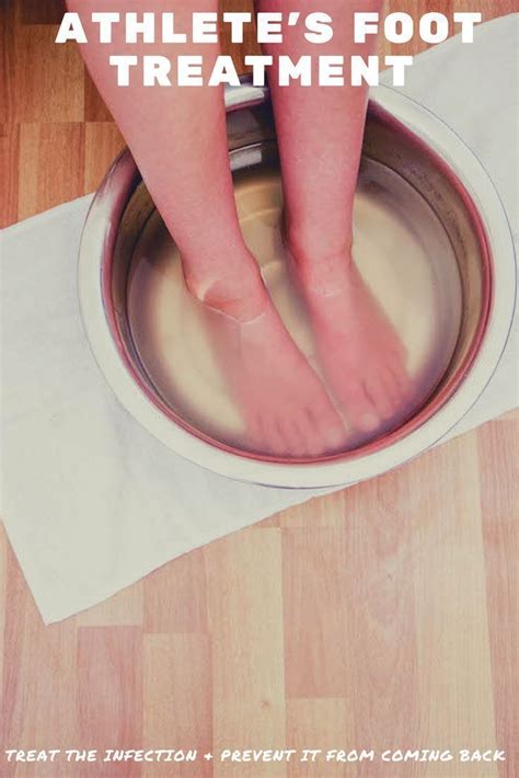 How to cure athlete s foot can natural remedies help – Artofit