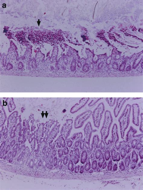 Representative Hematoxylin And Eosin H E Stained Sections From The