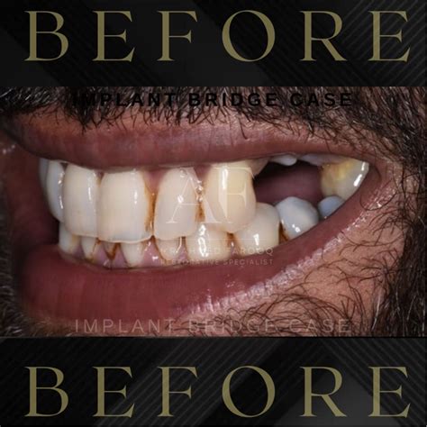 birmingham dentist dental dentistry dentistrymentor unitedkingdom