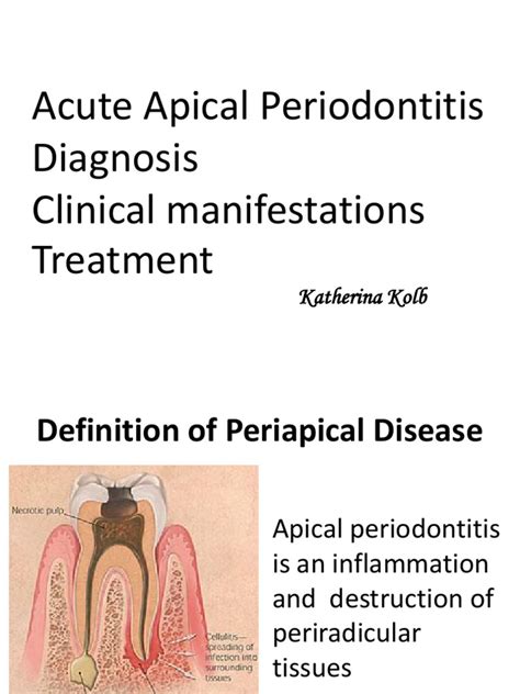 Lecture 6 6 Acute Apical Periodontitis Diagnosis Clinical Manifestations Treatment Pdf