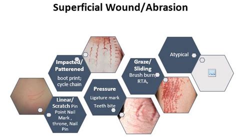 Abrasion Wound Diagram