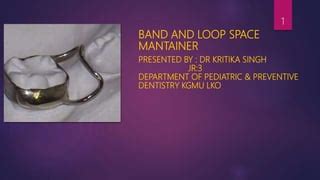 Band And Loop Space Maintainer Pptx