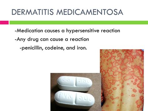 PPT - INFLAMMATORY DISORDERS PowerPoint Presentation, free download