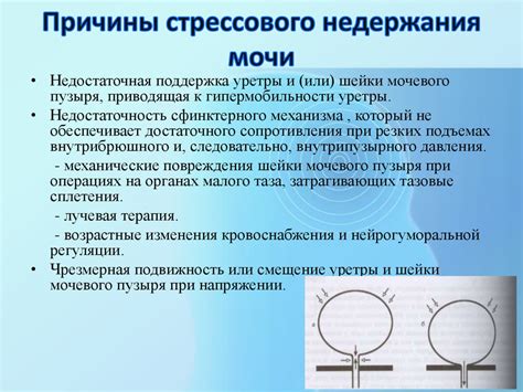 Недержание мочи у женщин - презентация онлайн