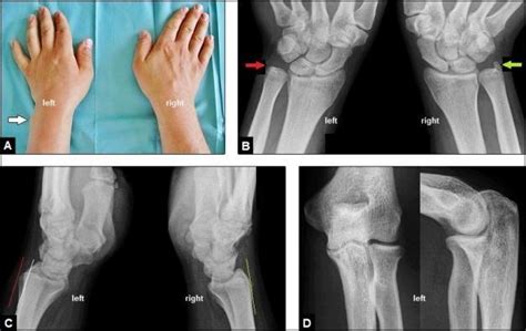 Case Presentation Initial Findings A Clinical Photograph Of Both
