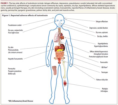 Glucocorticoids Side Effects