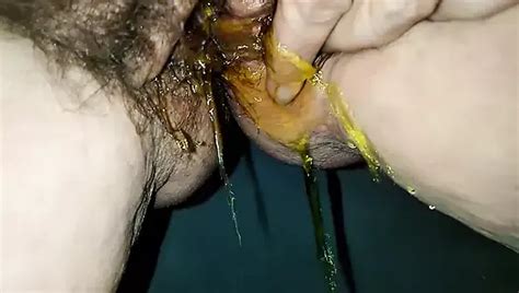 Black Countess My Clitoris Nude Pics XHamster