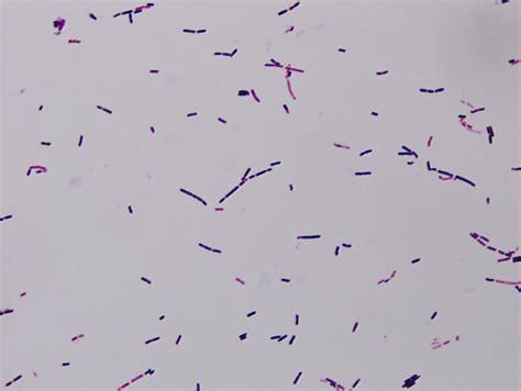 Bacillus Cereus Simple Stain