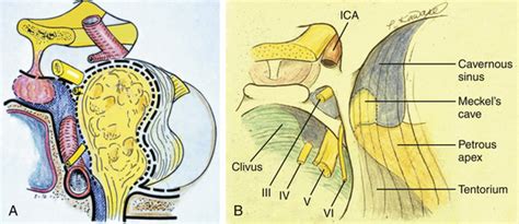 Meckels Cave Diagram