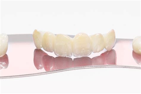 Поставяне на зъбни коронки: видове и цени | Medical Dent
