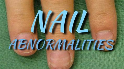 Nail Abnormality and Associated systemic disease – Platform | CME