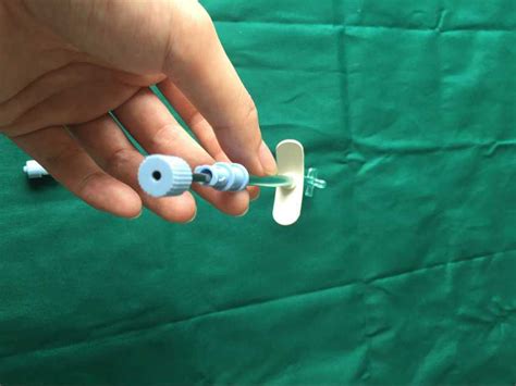 Обработка цистостомы: как обработать цистостому на дому, вызов уролога ...