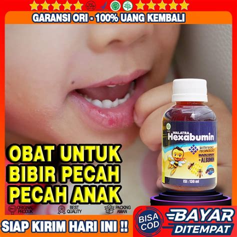 Jual Obat Bibir Pecah Pada Anak Obat Sariawan Untuk Anak Obat Susah