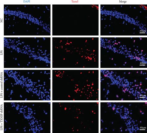 Neuronal apoptosis and expression of the apoptosis-related proteins in ...