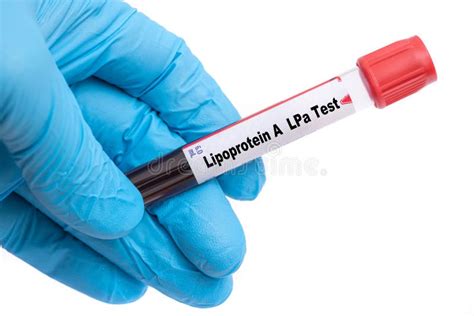 Lipoprotein A LPa Test Medical Check Up Test Tube With Biological