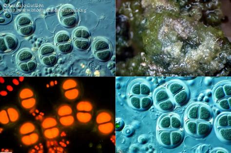 Chroococcus Tenax 5342 Biodiversidad Virtual Mundo Microscópico