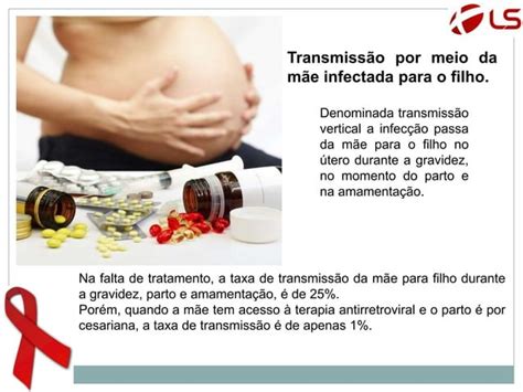 O Que é Hiv Como Se Contrai O Vírus O Que é Aids Ppt Download