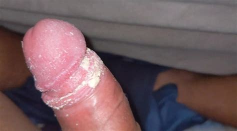 Sniff Amateur Smegma Cock ThisVid