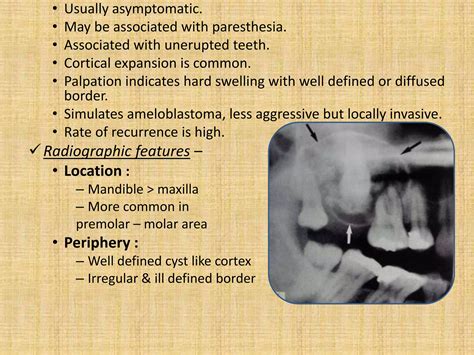 Mixed radiopaque & radiolucent lesions of jaw | PPTX