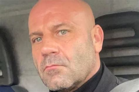 Brit Won T Let Partner See Her Naked After Breast Implant BURSTS