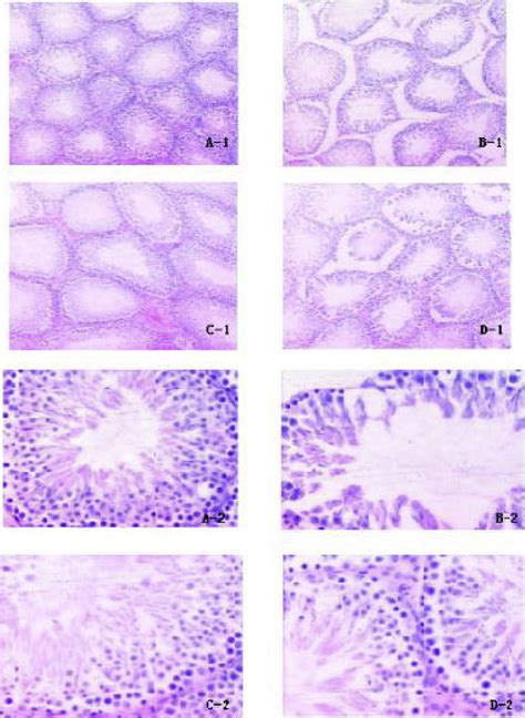 Histological Examination Of Testis A 1anda 2 Sham Operation Healthy